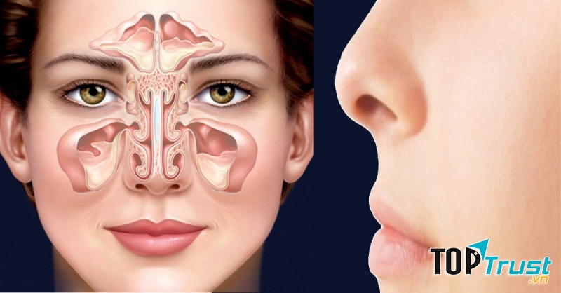 Xịt trị viêm xoang mũi hiệu quả nhất hiện nay